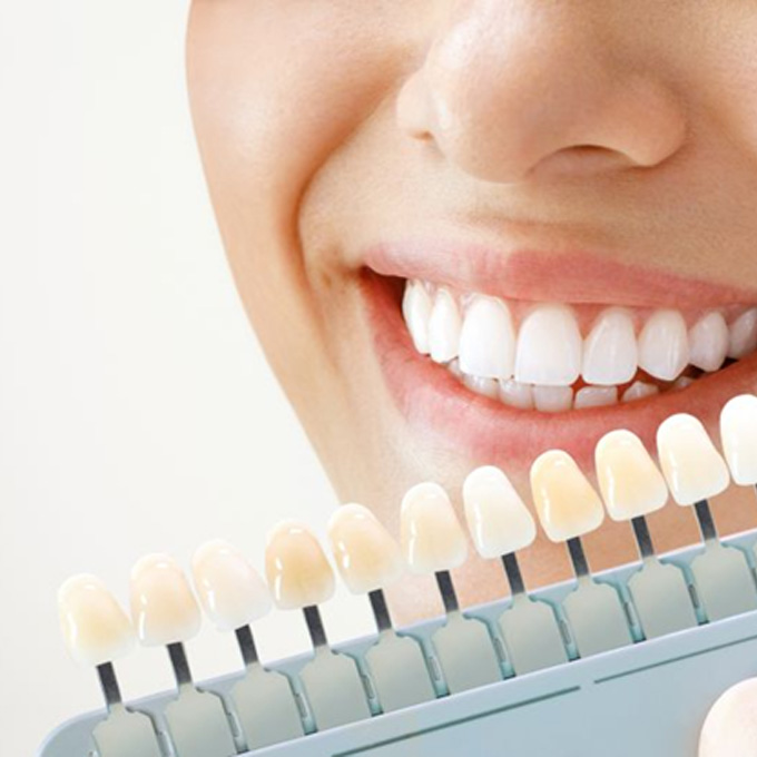 Dental shade guide next to woman’s smile